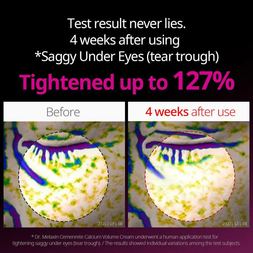 Cemenrete Calcium Intense Ampoule Plus