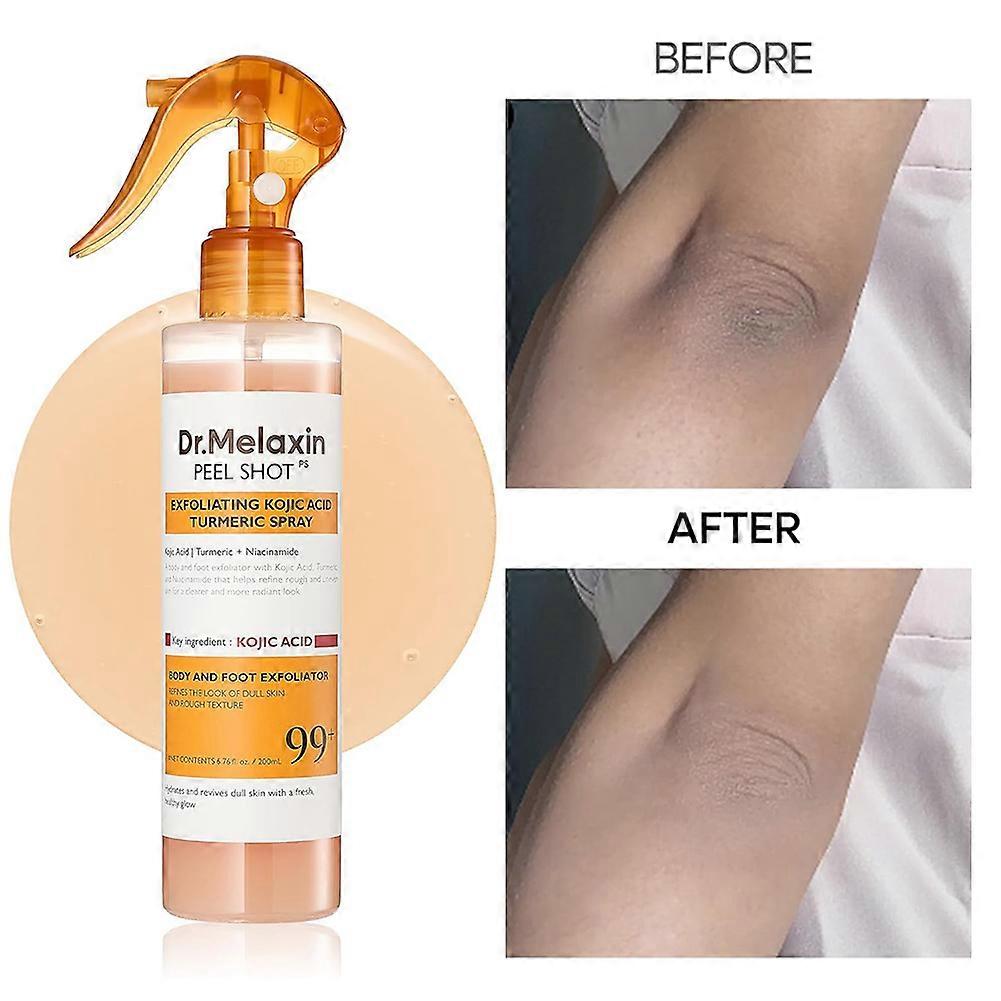 Peel Shot Exfoliating Kojic Acid Turmeric Spray