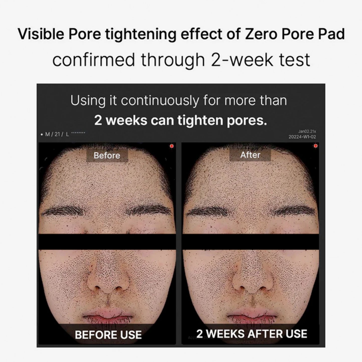 Zero Pore Pad - Exfoliating Toner Pads for Clear, Smooth Skin