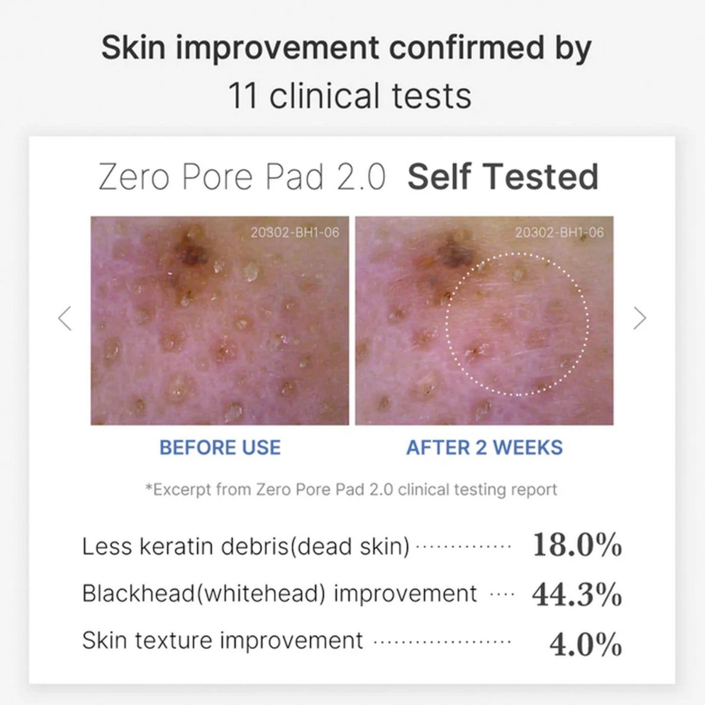 Zero Pore Pad - Exfoliating Toner Pads for Clear, Smooth Skin