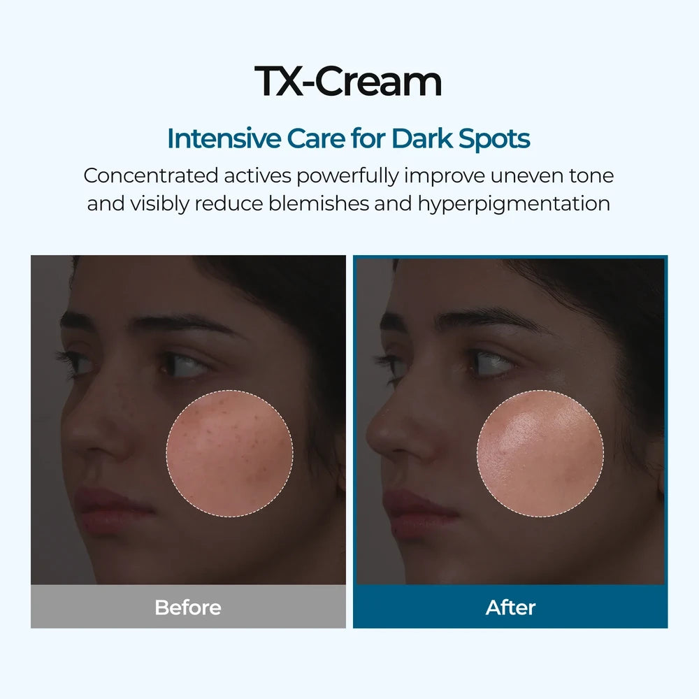 TX Cream - Intensive Spot Fading & Tone-Perfecting Cream