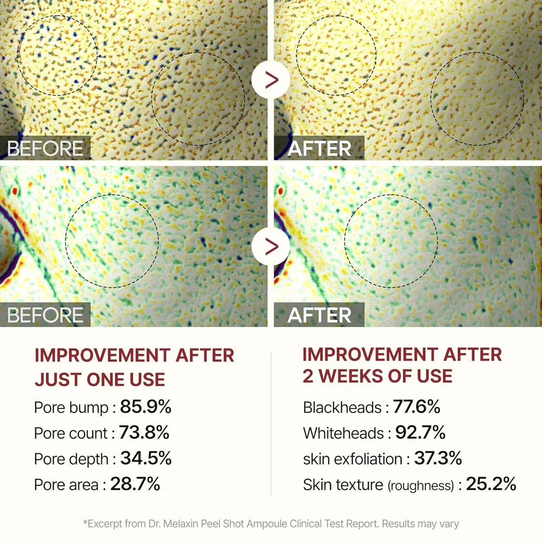 Rice Peel Shot Serum Ampoule - Smooth, Radiant Skin with Dual Rice Power